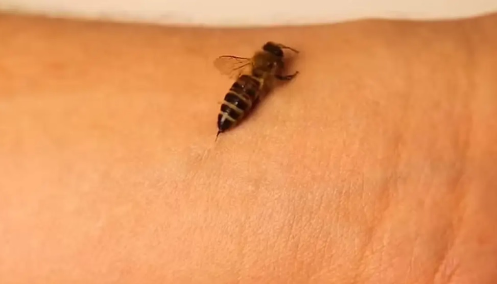 شاهد عن قرب ما يحدث عندما تلدغك نحلة