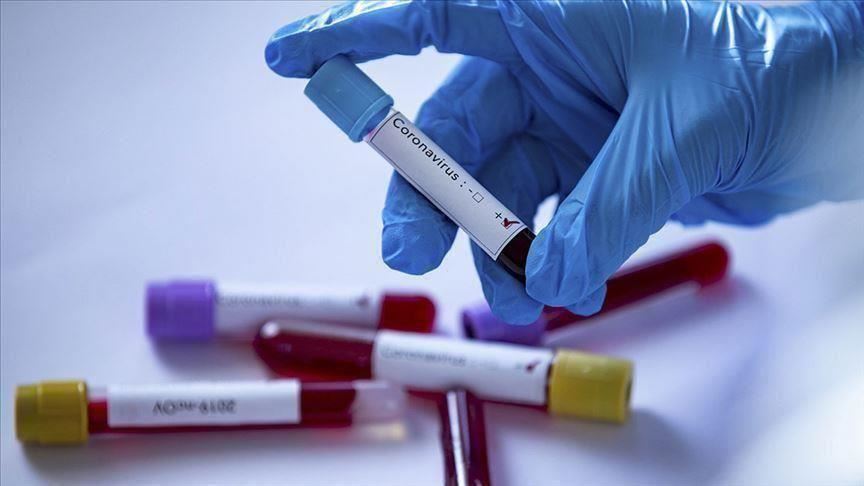 وزارة الصحة: تم اليوم تسجيل 21 إصابة جديدة بفيروس كورونا و12 (...)