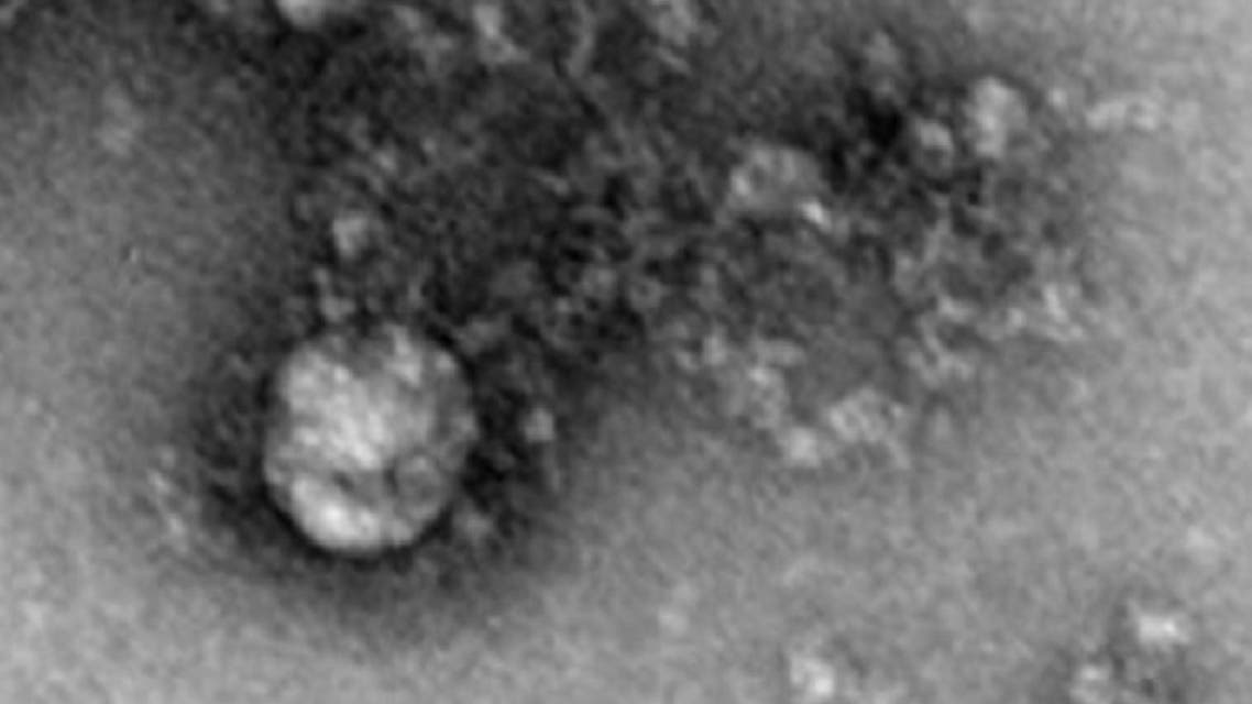 شاهد أول صورة للطفرة البريطانية القاتلة من فيروس كورونا