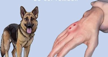 وزارة الصحة: 6 أشخاص تعرضوا لعضة كلب في كيفه