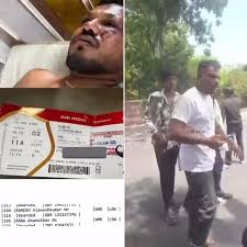 الناجي الوحيد من تحطم الطائرة الهندية يروي تفاصيل 