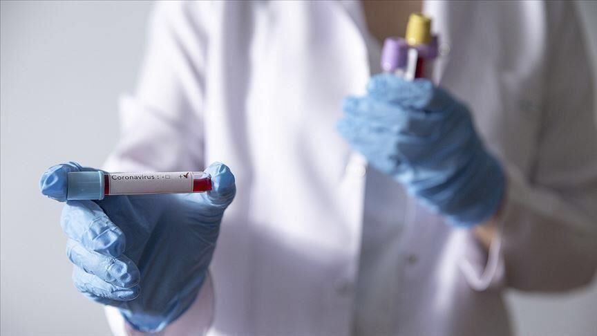 عودة ارتفاع وفيات كورونا اليوم: 13 وفاة و246 إصابة جديدة&nbsp;(…)