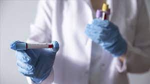 وزارة الصحة: 5 وفيات بسبب كورونا و282 إصابة جديدة