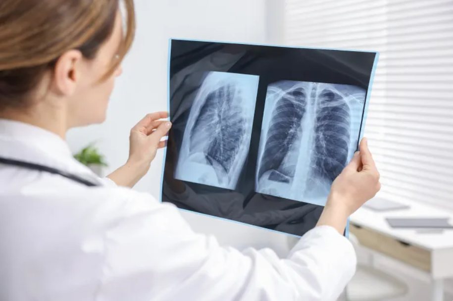 دراسات طبية: لهذا تتأثر النساء بأمراض الرئة أكثر من الرجال